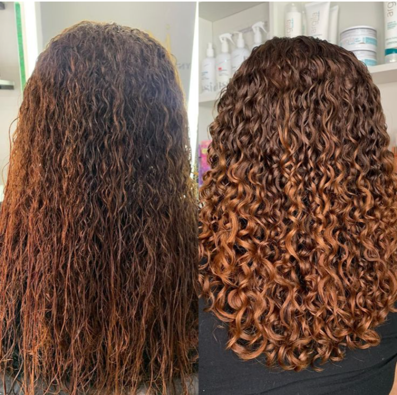 Antes e Depois 4